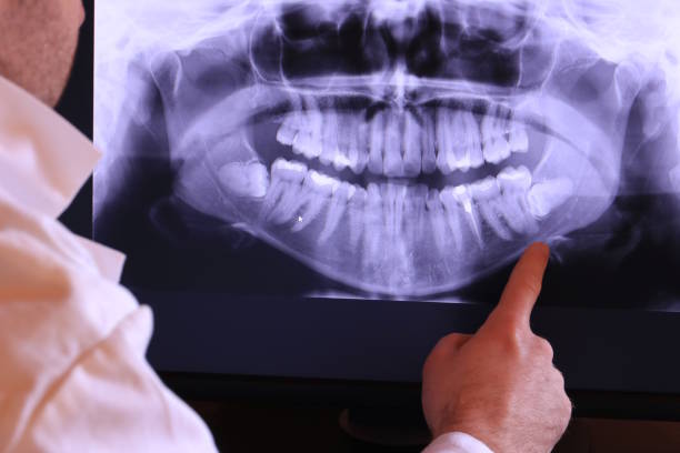Best Pediatric Emergency Dentist in Lexington, TX