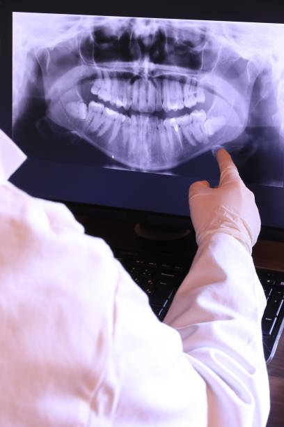 Best Emergency Root Canal Treatment in Lexington, TX